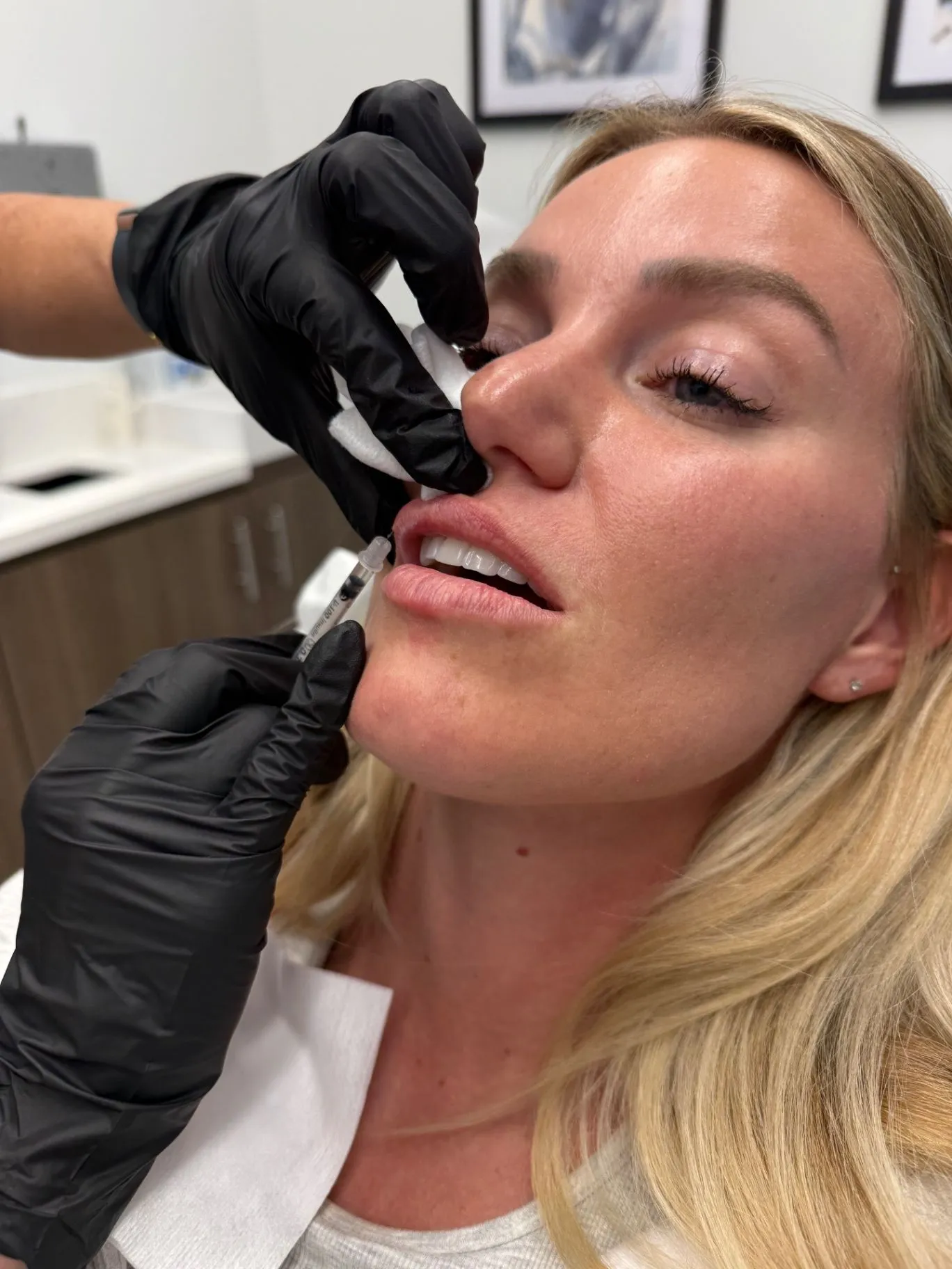 Gloved hands performing a lip injection treatment